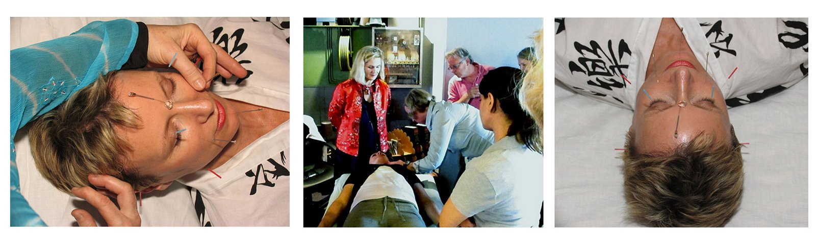 3-pics-w Constitutional Facial Acupuncture Seminar Series, Australia 2025