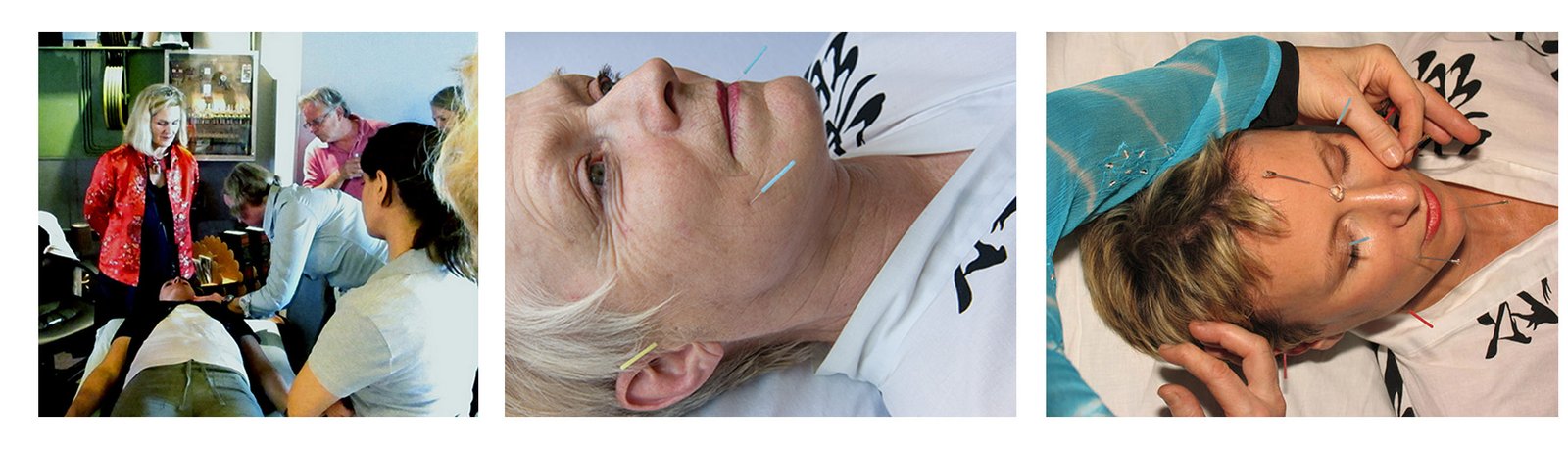 3-pics Constitutional Facial Acupuncture Seminar Series, Australia 2025