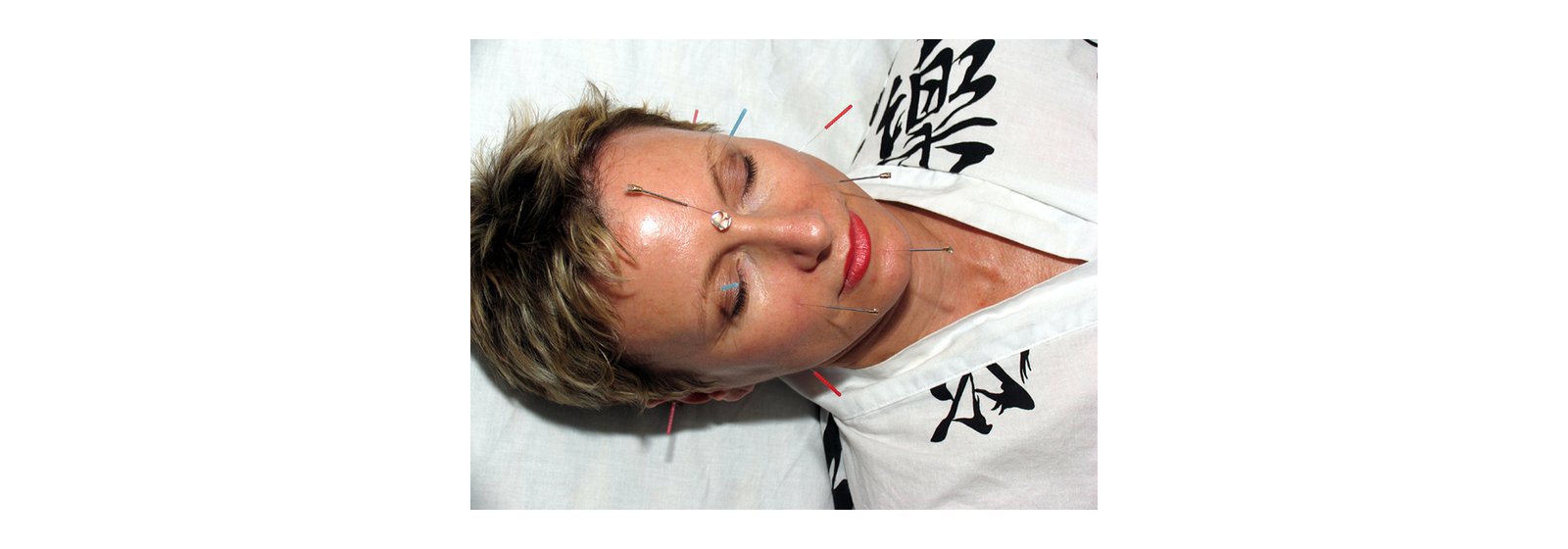 diamond-2a Constitutional Facial Acupuncture Seminar Series, Australia 2025