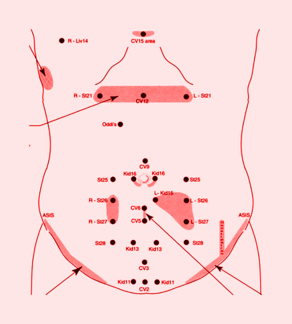 Foundations in Kiiko Matsumoto Style Acupuncture- Australia - 2026
