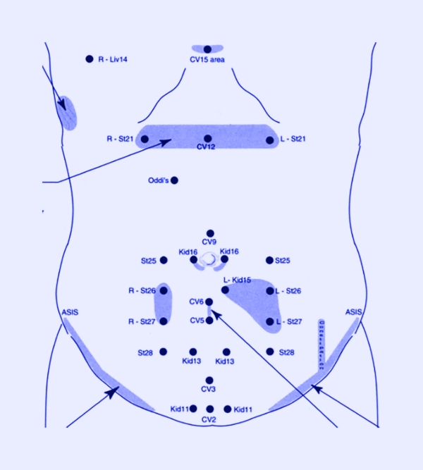Kiiko Matsumoto Style Acupuncture: the power of palpation and creating change - Free Webinar
